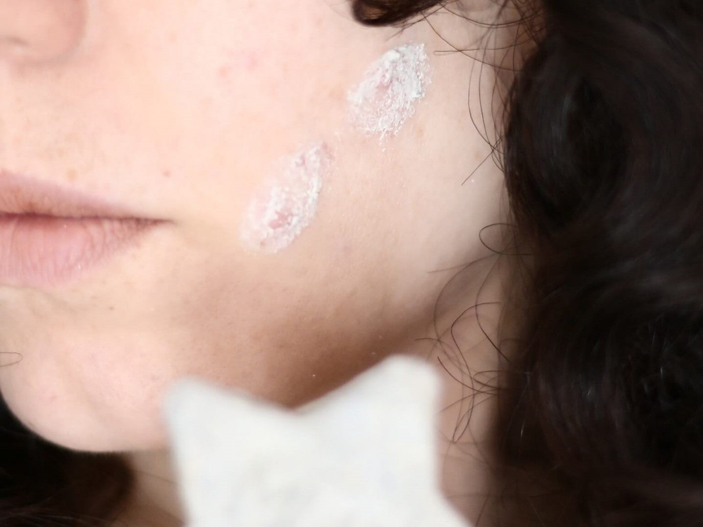 Stickers Solúveis para Borbulhas – Seca Borbulhas (Acne e Marcas de Acne)